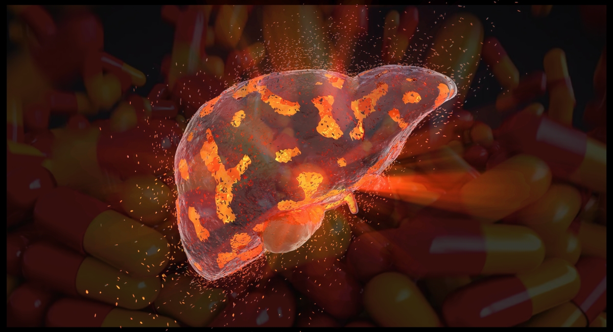 supplements that can cause liver toxicity and how to detoxify your liver
